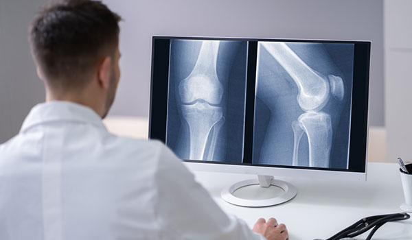 digital-xray-in-eluru